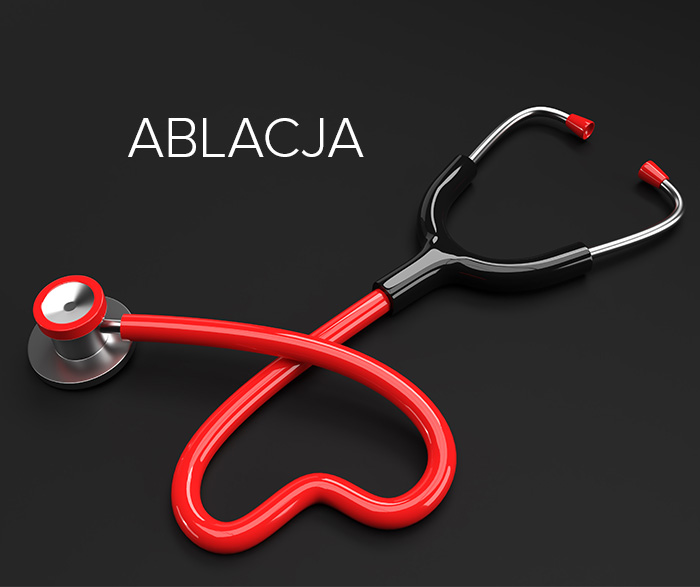 Ablacja-dowiedz się więcej